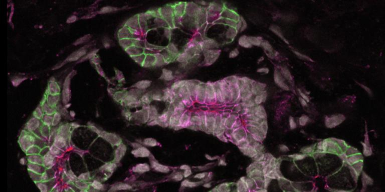 Image of salivary glad by the Knox Lab